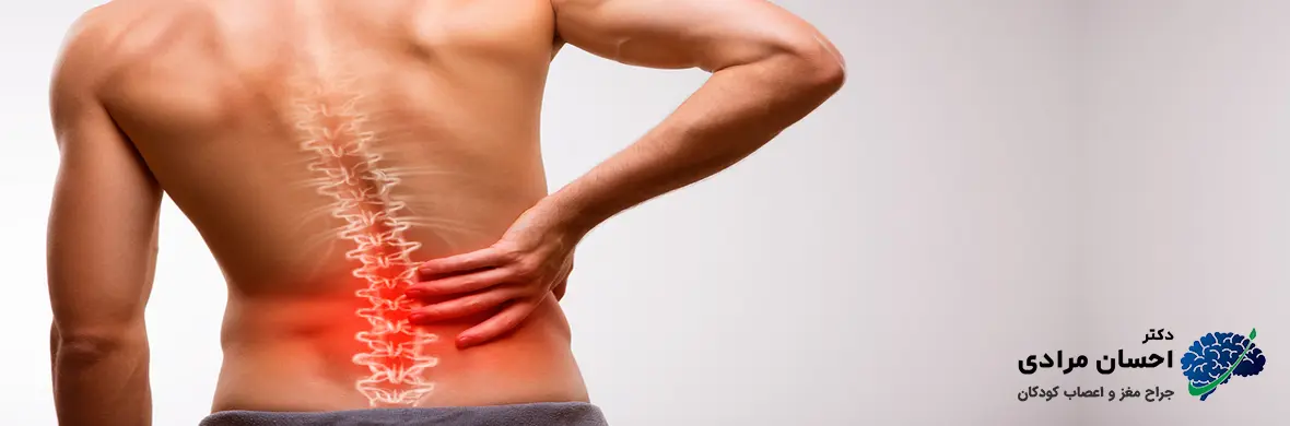 تصویر لیز خوردگی مهره ستون فقرات
