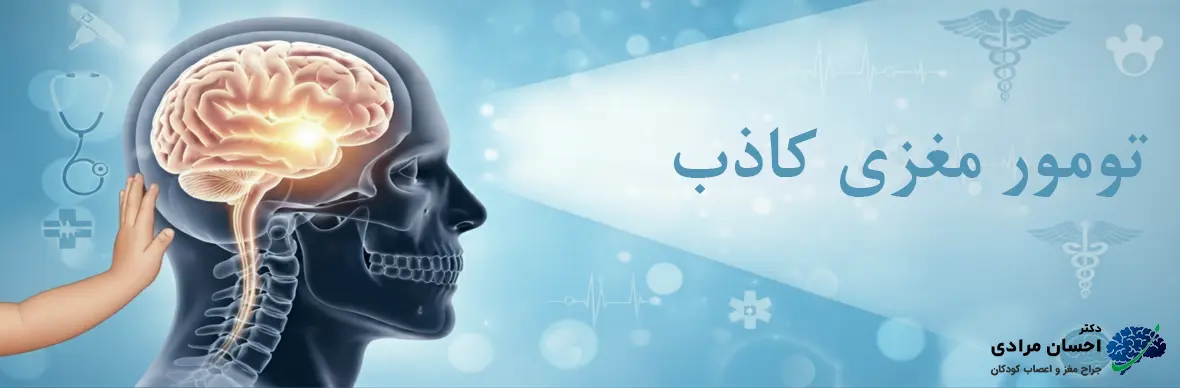 تصویر شماتیک تومور مغزی کاذب