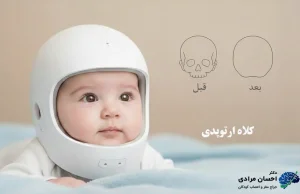 کلاه ارتوپدی