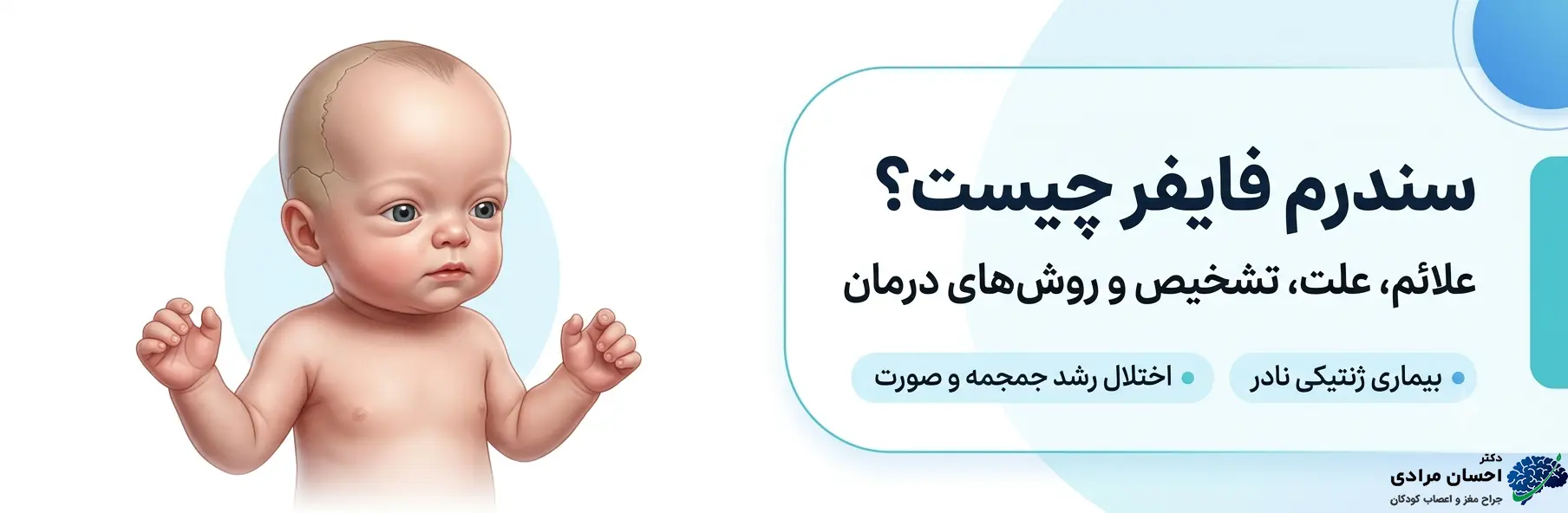 نمای شماتیک سندرم فایفر شامل کرانیوسینوستوز، برجستگی چشم‌ها و پهن بودن انگشت شست