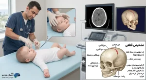 تشخیص اسکافوسفالی با معاینه و سیتیاسکن سهبعدی جمجمه